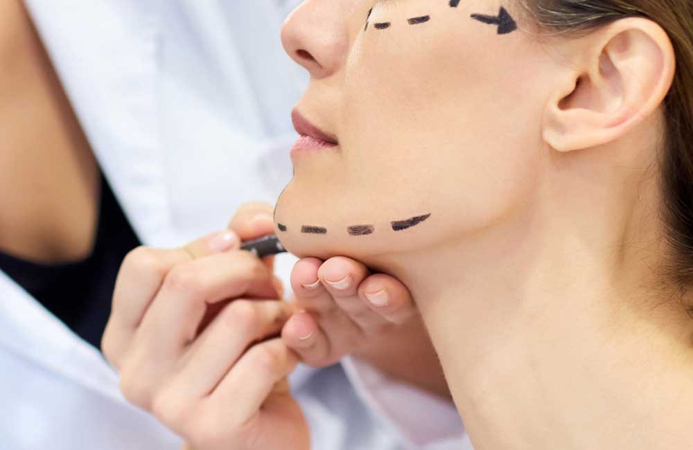 Lifting o cirugía del rejuvenecimiento facial