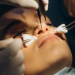 Banner MG 2