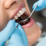The dentist provides gentle and convenient service, explaining each stage of treatment to the patient. She has high skills and the ability to provide comfort during the visit. Close-up tools. High quality photo